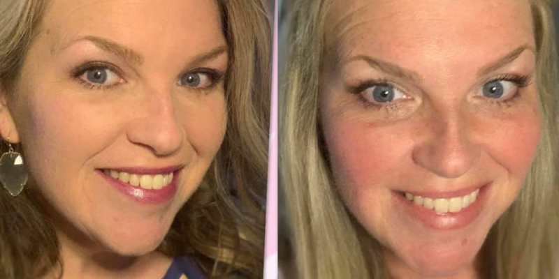 Thrive Skin with CBD - The results are in!